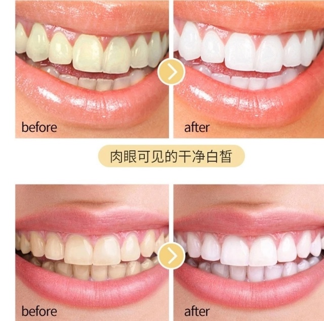 Зубной порошок для отбеливания зубов 22922715