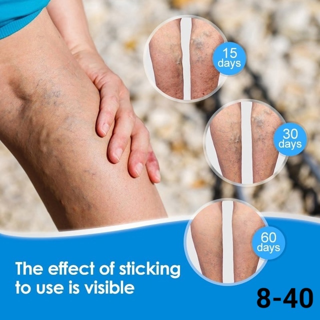 Артикул 22959172