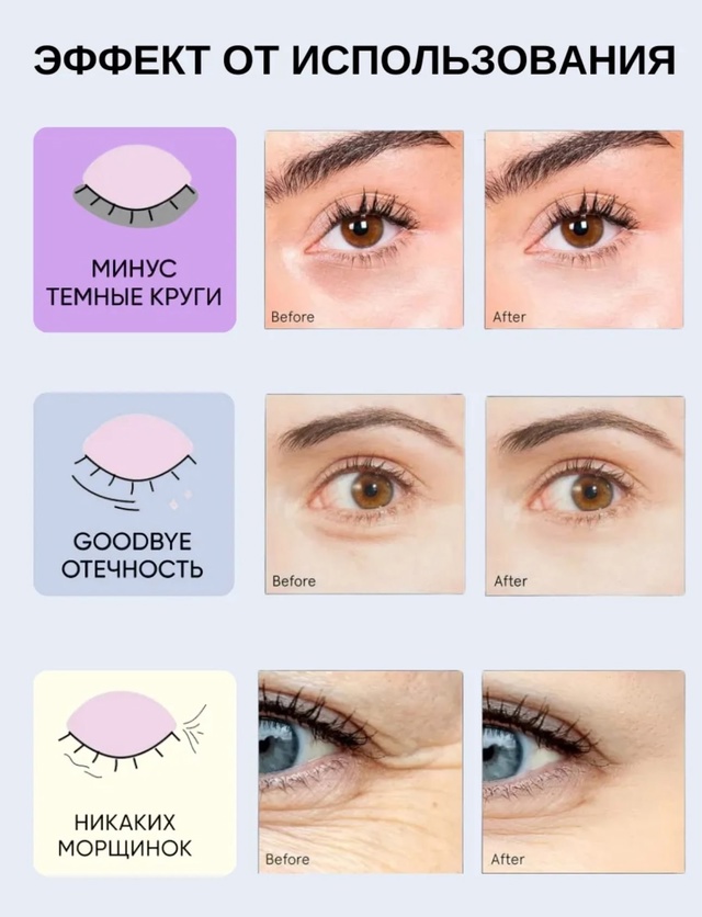 Патчи для вокруг глаз 22974633