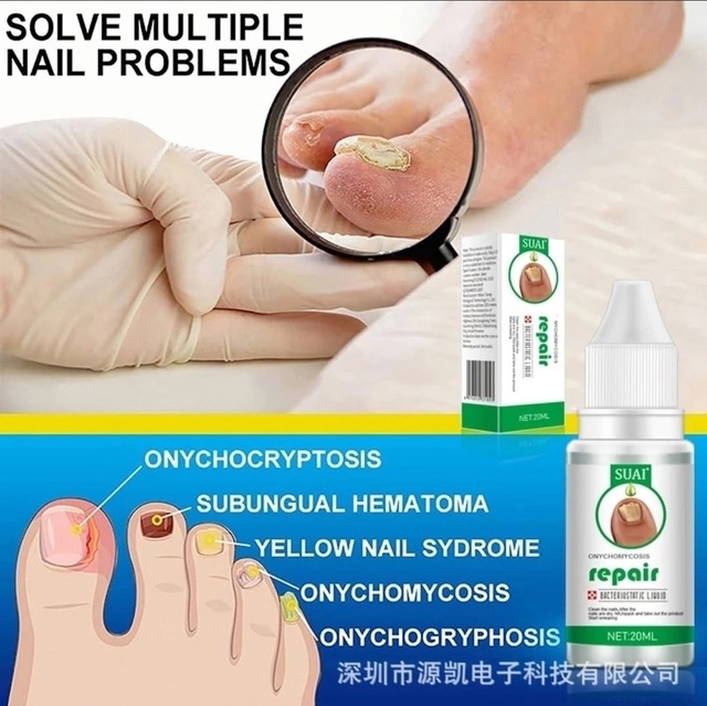 Сыворотка 23001522