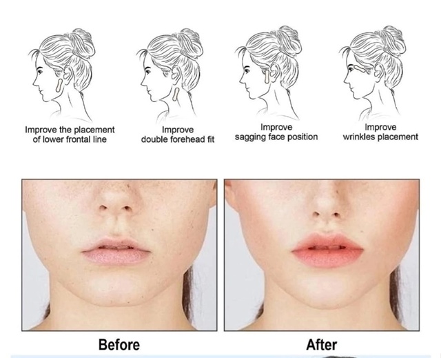 Тейпы для подтяжки лица прозрачные 100 шт 23004906