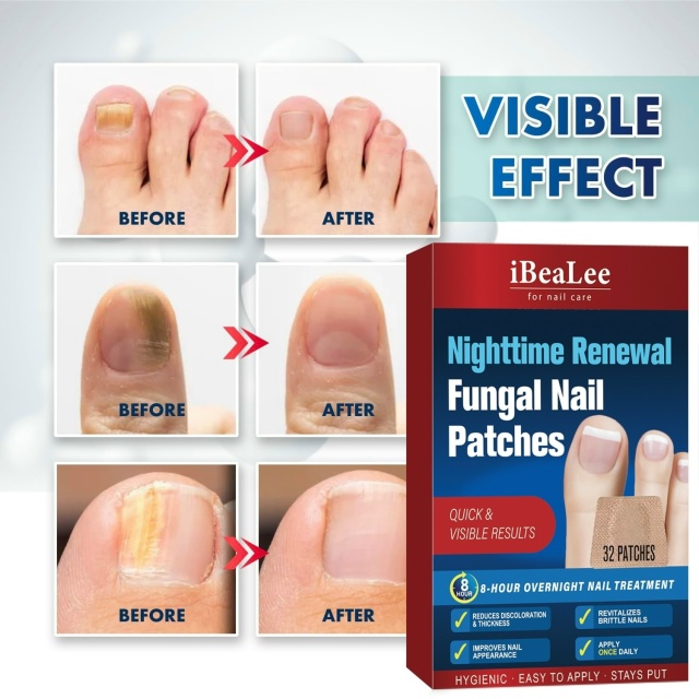 Пластырь 23051807