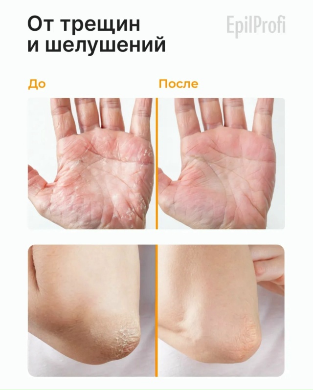 Крем+Воск от трещин 23090380