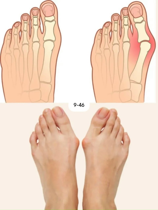 Расширитель для пальцев ног 23117550